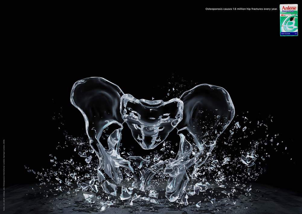 PELVIS.jpg