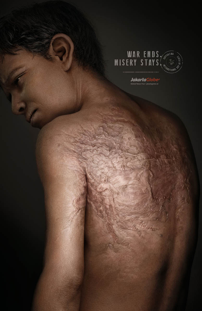 Scars of Misery-Boy_Outdoor.jpg