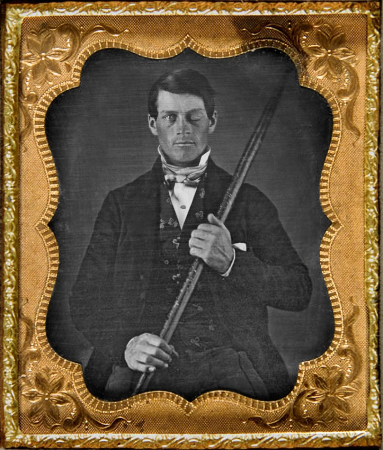 Damon Stapleton: Advertising. Phineas Gage is a strange story we should all know
