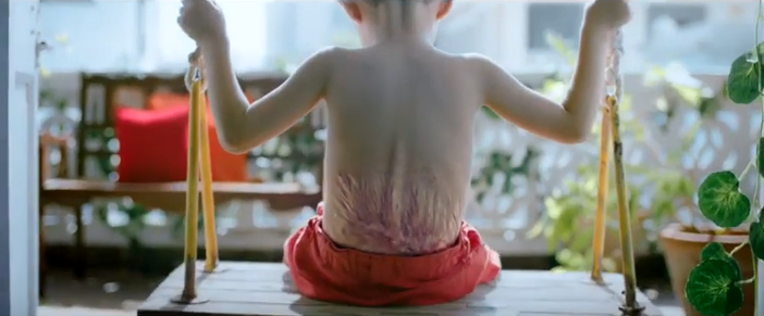 BBDO Pakistan releases confronting film to spread awareness of burns caused through negligence with hot tea