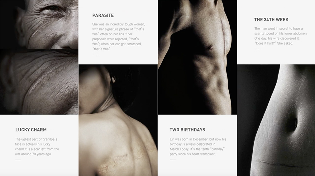 Tencent Shenzhen launches digital photography exhibition ‘Traces of Pain’ telling the struggles of mutilation and scars patients