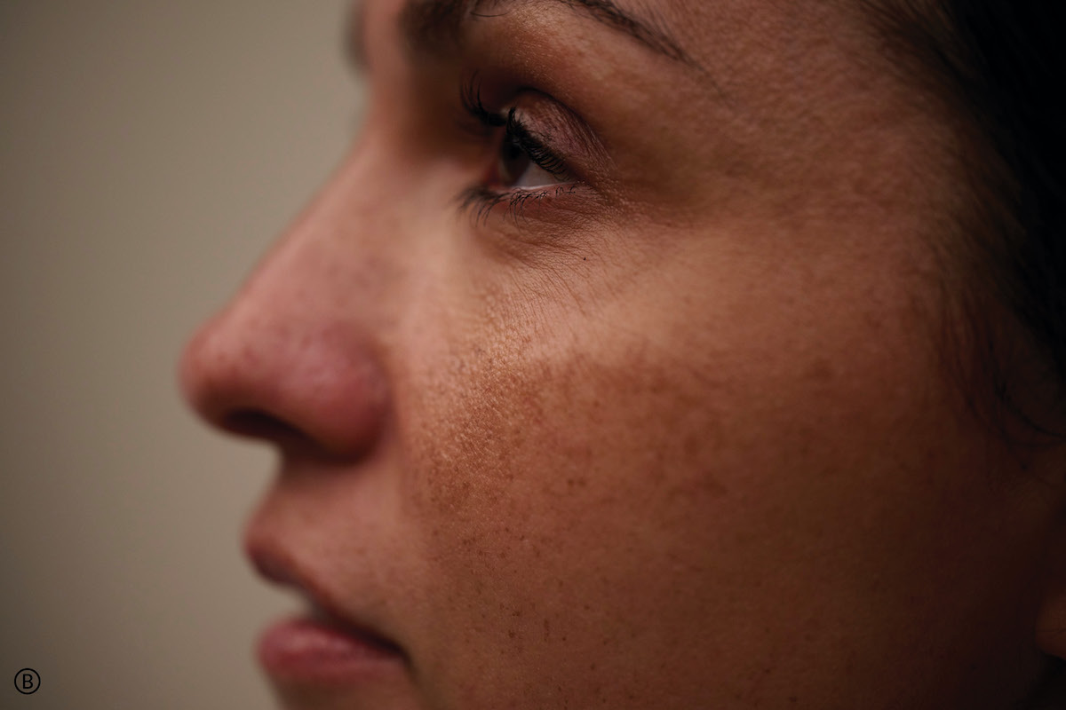 Bodyright urges us to be Unretouched and Unashamed with new ‘March Unfiltered’ movement and campaign via TBWANZ