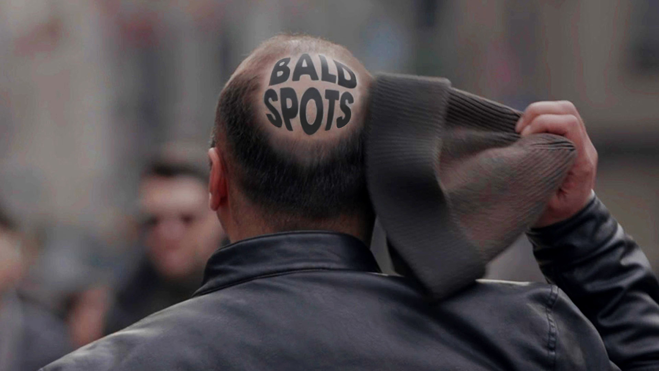 Clear takes on baldness with head-turning bald spots campaign via MullenLowe Singapore